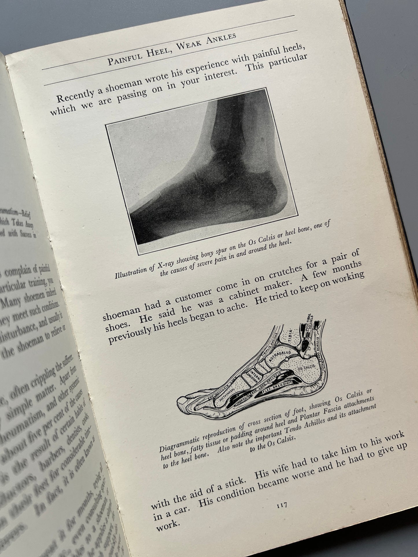 A course of study in scientific shoe fitting and salesmanship, M. Scholl - International School of Practipedics, 1930